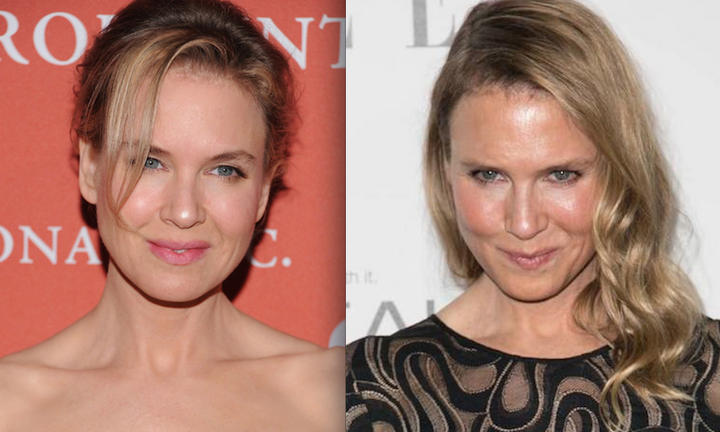 Renee Zellweger gây ngạc nhiên với khuôn mặt biến dạng