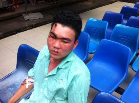 Dân 'tố' CSCĐ vung gậy: Chuyển hồ sơ sang cơ quan điều tra