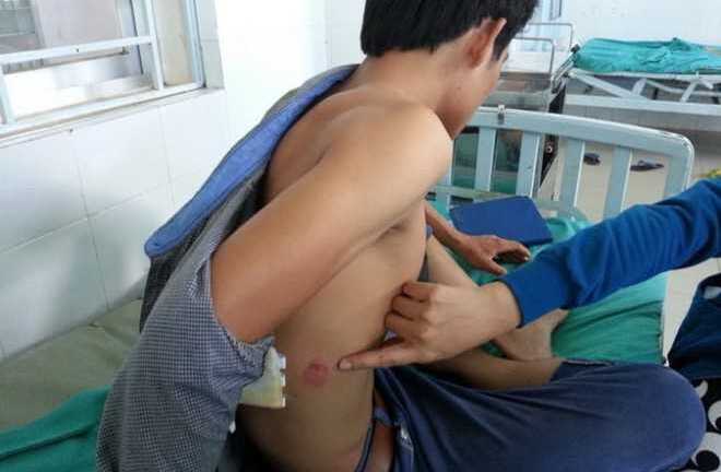 Dân bao vây, tố cảnh sát giao thông đánh người