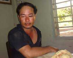 Cuồng ghen, đến bệnh viện kết liễu đối thủ