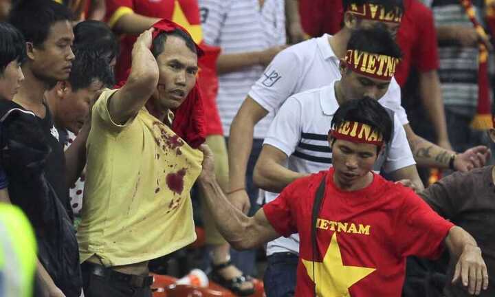 CĐV Việt Nam bị fan cuồng Malaysia đánh vỡ đầu đã xuất viện