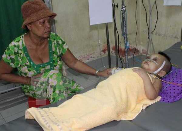 Bé 2 tuổi bị bà ngoại đánh đến lơ mơ, phù nề