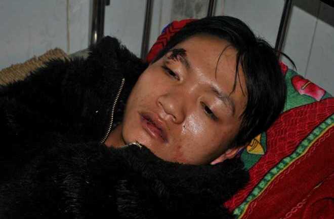 Hai thanh niên nghi là cẩu tặc giả chết để sống sót