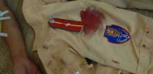 Vi phạm giao thông, chém cảnh sát để tẩu thoát