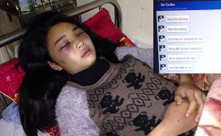 Nữ sinh bị đánh hội đồng dã man trong khách sạn