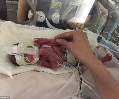 Sự ra đời kỳ diệu của bé gái trong phút hấp hối của người mẹ