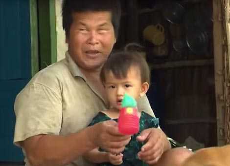 Người có biệt tài đoán thời tiết bằng... tai