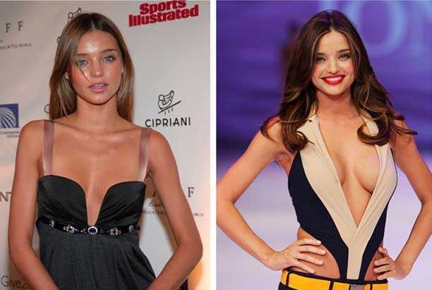 Những vụ sao âm thầm dao kéo hiếm người biết