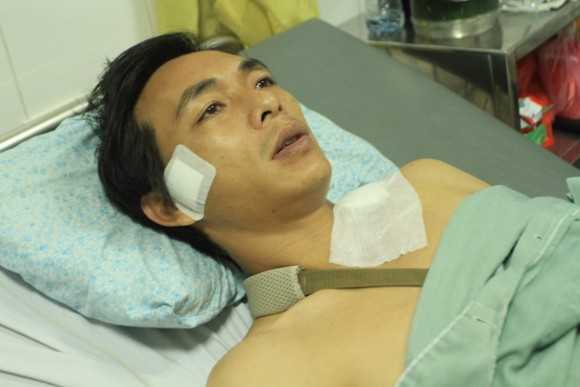 Ngoại binh SHB Đà Nẵng khiến cầu thủ Hải Phòng vỡ xương quai xanh