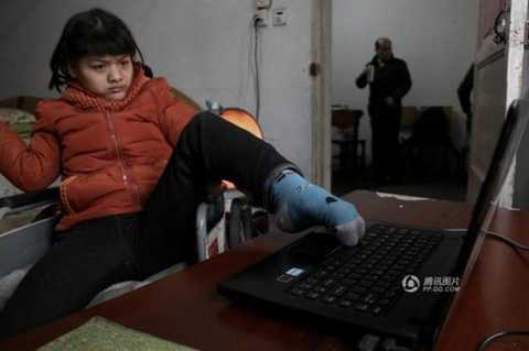 Chuyện kỳ diệu về cô bé bại não viết tiểu thuyết bằng 1 chân