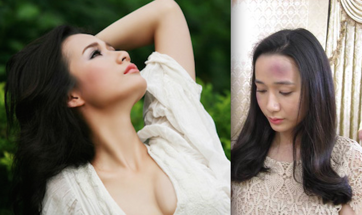 Mỹ nhân phim 'Lập trình trái tim' bị giang hồ đánh bầm dập