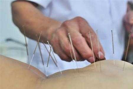 Cai nghiện bằng phương pháp châm cứu