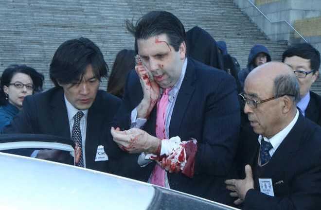 Đại sứ Mỹ tại Hàn Quốc phải khâu 80 mũi sau vụ tấn công