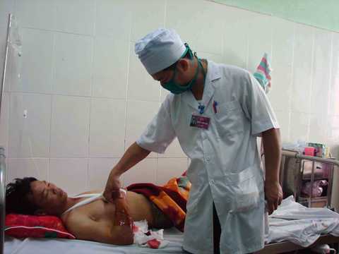 Nối thành công cánh tay bị đứt lìa