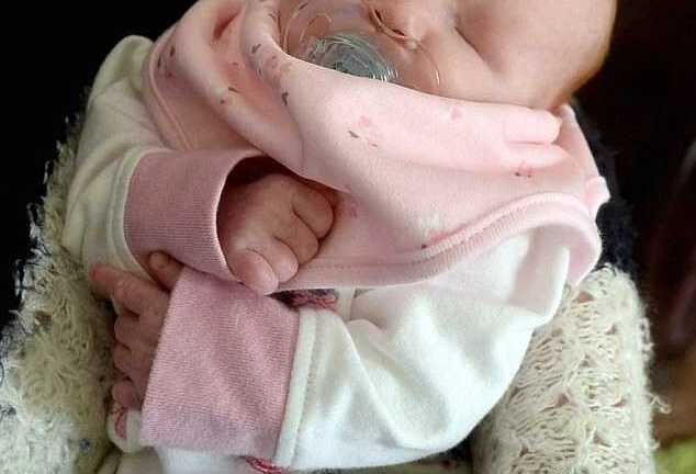 Đau lòng bé sơ sinh không có mắt