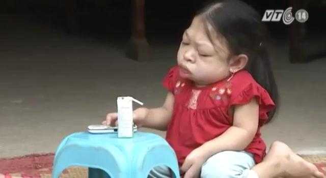 Bệnh lạ khiến người giống ếch ở Hà Nội