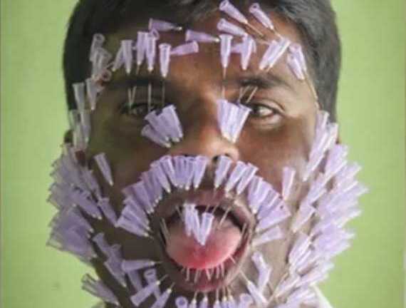 Kinh hoàng người đàn ông xuyên 550 cây kim vào mặt