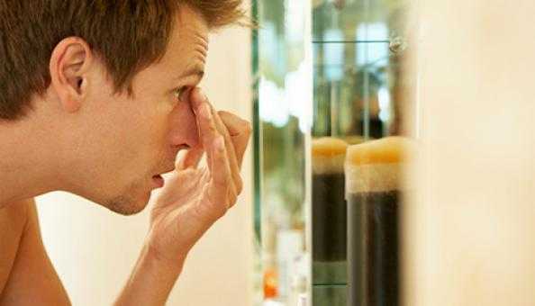 5 cách hữu hiệu đánh bay sẹo mụn