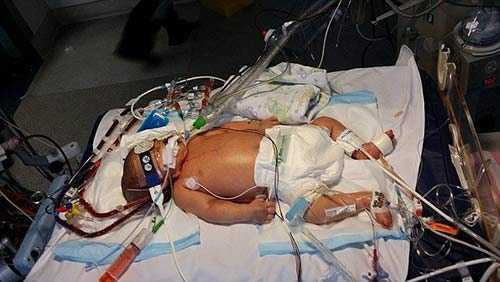 Tại sao chỉ vì một nụ hôn, trẻ có thể gặp 'tử thần'?