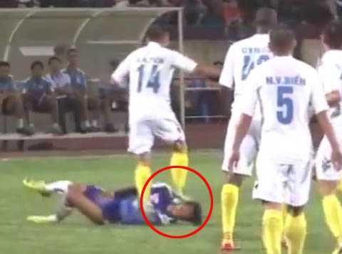 Cầu thủ HAGL bị giẫm vào mặt