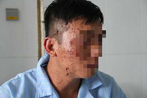 Con trai kể lại giây phút kinh hoàng vụ bố ôm mìn vào phòng kích nổ