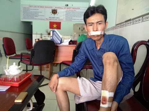 Nhóm côn đồ hung hãn đập phá chốt trực, tấn công bảo vệ