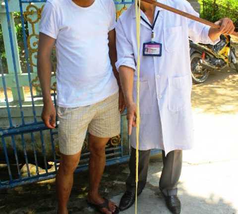 Rùng mình sán dài 12 mét 'làm tổ' trong ruột người đàn ông