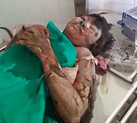 Lời kêu cứu đớn đau từ nạn nhân vụ cháy chợ Phùng Khoang