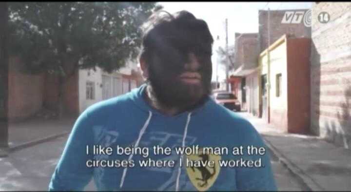 Clip: Gặp gỡ gia đình 'người sói' duy nhất trên thế giới