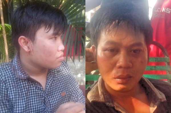 2 phóng viên bị côn đồ đánh đập: Làm rõ dấu hiệu bảo kê, trả thù