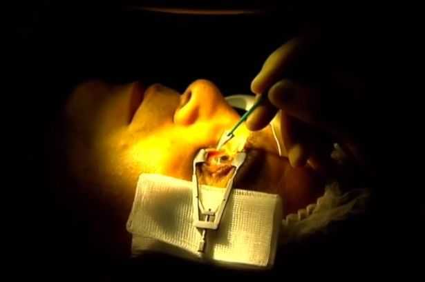 Video: Cận cảnh ca phẫu thuật mắt bằng laser