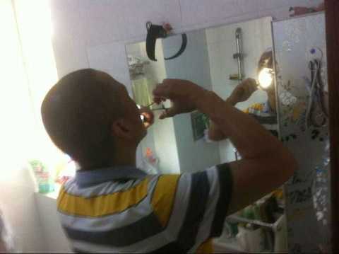 Người đàn ông tự 'phẫu thuật' cắt khối u trong miệng hơn 10 lần