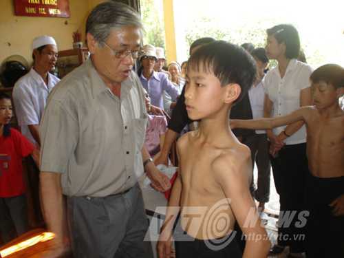 Náo loạn ngôi làng trẻ em bỗng dưng tật nguyền hàng loạt