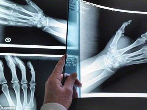 Chụp X-quang và CT có gây ung thư khủng khiếp?