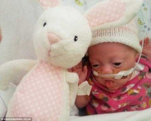 Không thể tin bé sơ sinh chỉ 0,62 kg