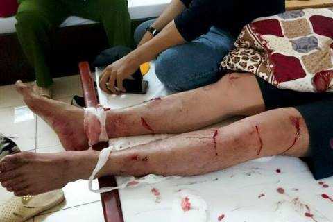 Nhóm cascadeur bị giang hồ Cần Thơ đánh chém viết đơn bãi nại