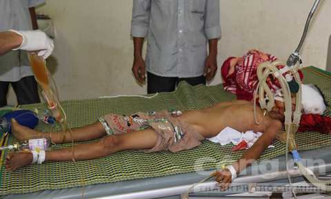 Hai anh em ruột bị dượng dùng gậy tre đánh thương vong