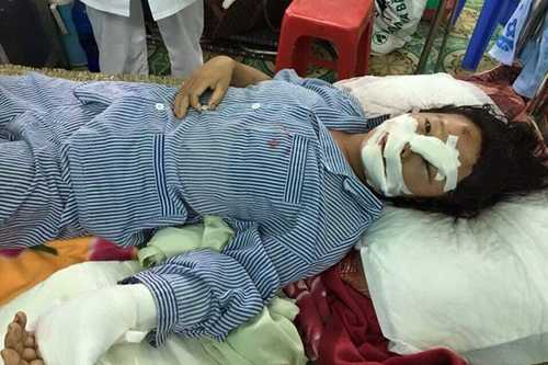 Kẻ cắt gân tay, gân chân vợ ra đầu thú