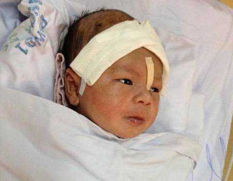 Bé trai 12 ngày tuổi bị đâm xuyên não sắp được xuất viện