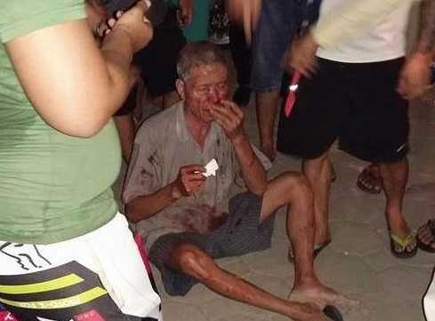 Va chạm giao thông, nam thanh niên đánh cụ ông 70 tuổi chảy máu