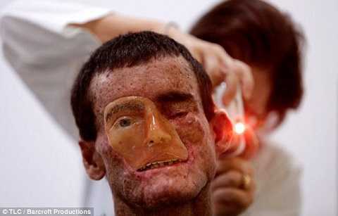 Kỳ lạ dân làng cứ ra nắng là bị thiêu đốt