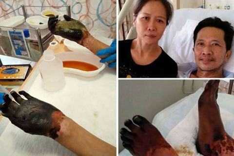 Ngộ độc khủng khiếp do ăn cá sống