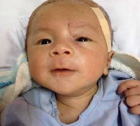 Ngày mai bé trai bị đâm xuyên não sẽ xuất viện