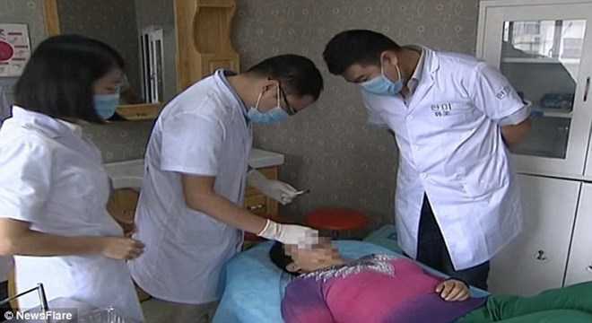 Kinh hoàng chuyện người vợ bị chồng cắn và nuốt mũi