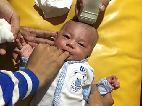 Ảnh: Bé 12 ngày tuổi bị đâm xuyên não bụ bẫm ngày tái khám