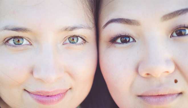 Tẩy nốt ruồi có gây ung thư?