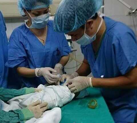 Ca cấp cứu hiếm gặp: Mổ lấy con từ người mẹ bỏng 98%