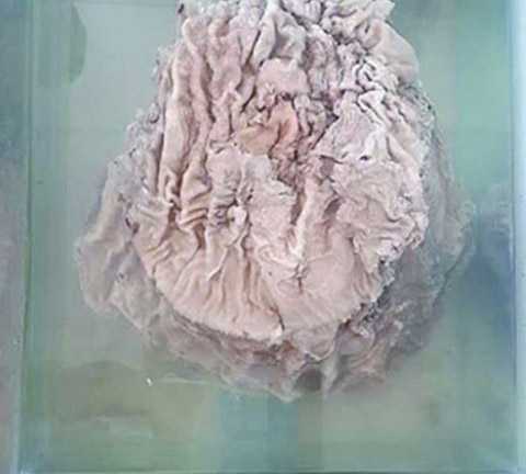 Đi nhặt rác, đào được linh chi ước giá gần 1 tỷ USD