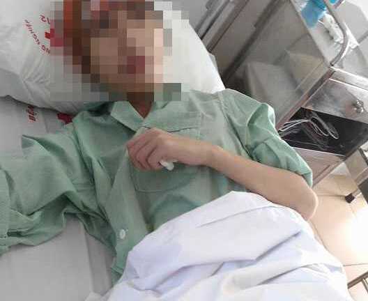 Bác sỹ giật mình thiếu nữ 18 tuổi đã mắc bệnh ung thư dạ dày hiếm gặp