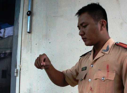 Bị truy đuổi, tên cướp lấy 'máu nhiễm HIV' dọa cảnh sát